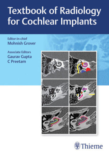Textbook of Radiology for Cochlear Implants - Mohnish Grover - Relié ...