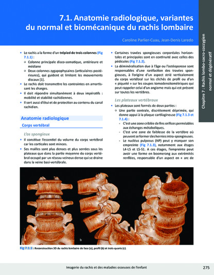 Imagerie du rachis et maladies osseuses enfant - Laredo - Sauramps Médical