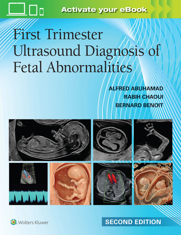 First Trimester Ultrasound Diagnosis of Fetal Abnormalities 2nd Edition