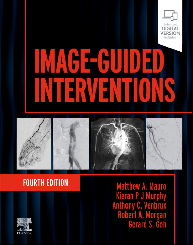 Image-Guided Interventions 4th Edition