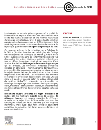 Imagerie diagnostique du sein