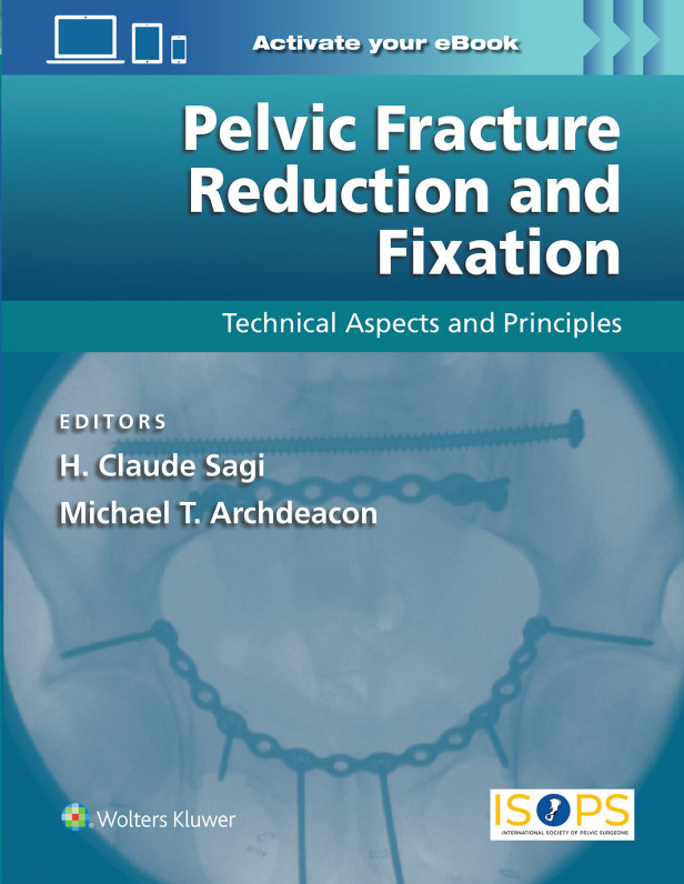 Pelvic Fracture Reduction and Fixation: Technical Aspects and Principles 1