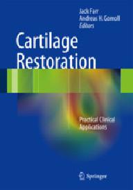 Cartilage restoration