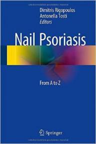 *nail psoriasis