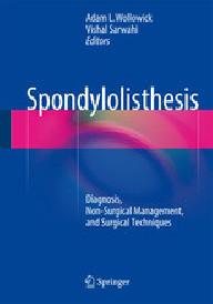 SPONDYLOLISTHESIS
