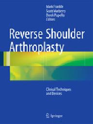 REVERSE SHOULDER ARTHROPLASTY