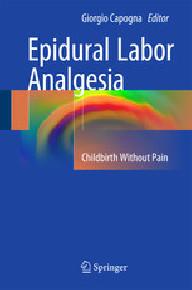 Epidural labor analgesia