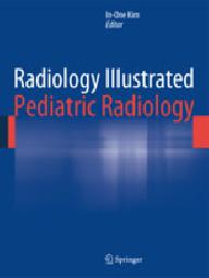 RADIOLOGY ILLUSTRATED...