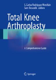 TOTAL KNEE ARTHROPLASTY