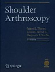 SHOULDER ARTHROSCOPY