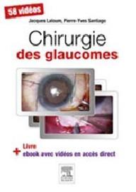 CHIRURGIE DES GLAUCOMES