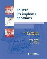 REUSSIR LES IMPLANTS DENTAIRES