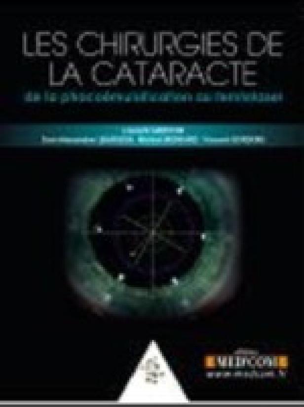 LES CHIRURGIE DE LA CATARACTE. DE LA PHACOEMULSIFICATION AU FEMTOLASER