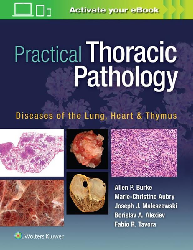 PRACTICAL THORACIC PATHOLOGY
