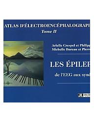 Les epilepsies de l'eeg aux...