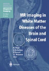Mr imaging in white matter...