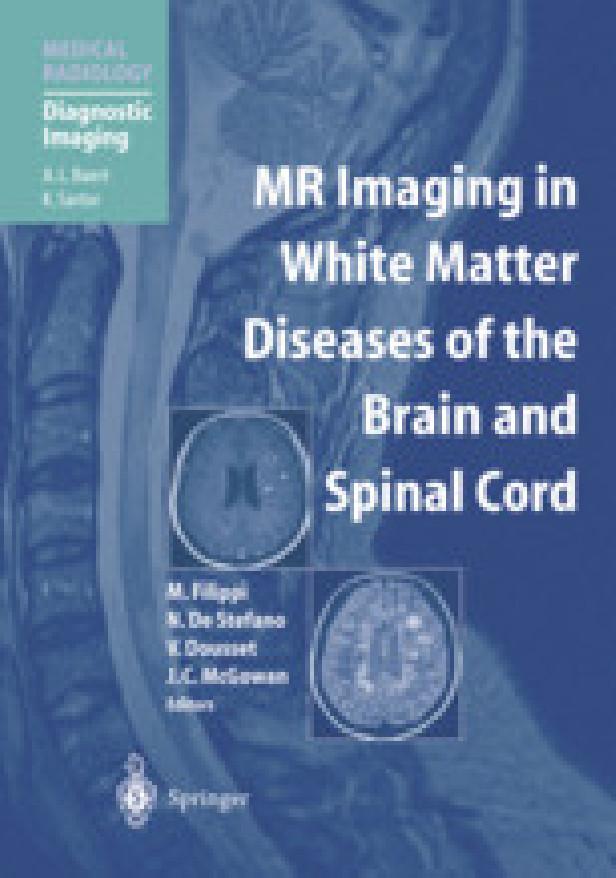 Mr imaging in white matter diseases of the brain and spinal cord