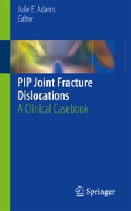 Pip joint fracture...