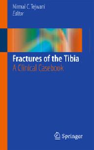 FRACTURES OF THE TIBIA
