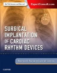 Surgical implantation of...