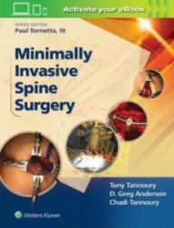 Minimally invasive spine...