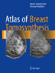ATLAS OF BREAST TOMOSYNTHESIS