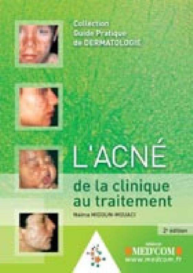 L ACNE 2E ED CLINIQUE AU TRAITEMENT