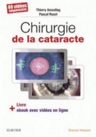 CHIRURGIE DE LA CATARACTE -...