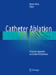 Catheter ablation