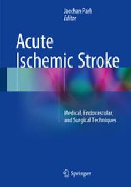 Acute ischemic stroke