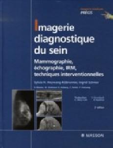 IMAGERIE DIAGNOSTIQUE DU SEIN