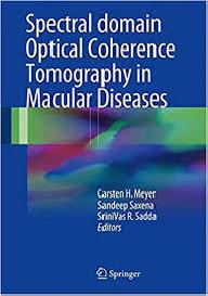 Spectral domain optical...