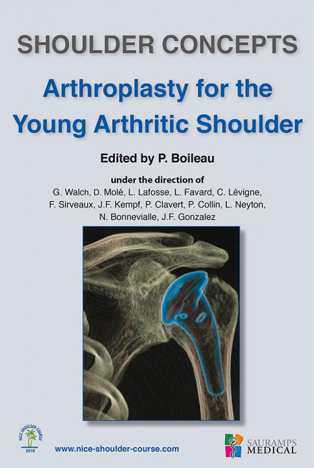 SHOULDER CONCEPTS ARTHROPLASTY FOR THE YOUNG ARTHRITIC SHOULDER - COLL NICE SHOULDER
