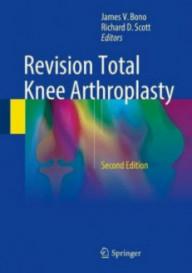 REVISION TOTAL KNEE...