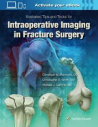 Intraoperative imaging in...
