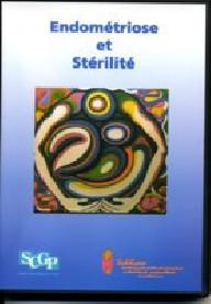 ENDOMETRIOSE ET STERILITE DVD