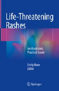 Life-threatening rashes