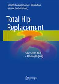 Total hip replacement