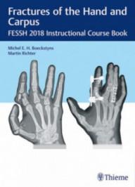 FRACTURES OF THE HAND AND...