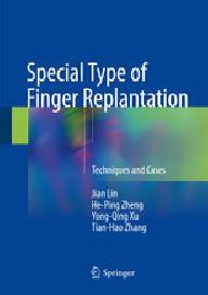Special type of finger...