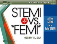 Stemi vs "femi"
