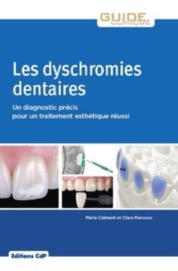 LES DYSCHROMIES DENTAIRES - UN DIAGNOSTIC PRECIS POUR UN TRAITEMENT ESTHETIQUE REUSSI