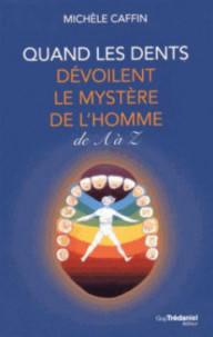 QUAND LES DENTS DEVOILENT...