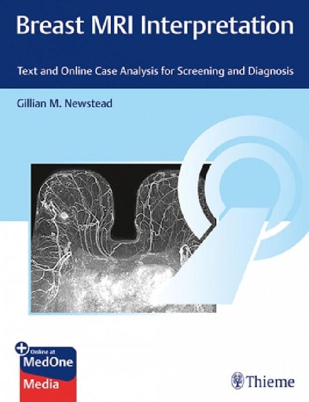 BREAST MRI INTERPRETATION