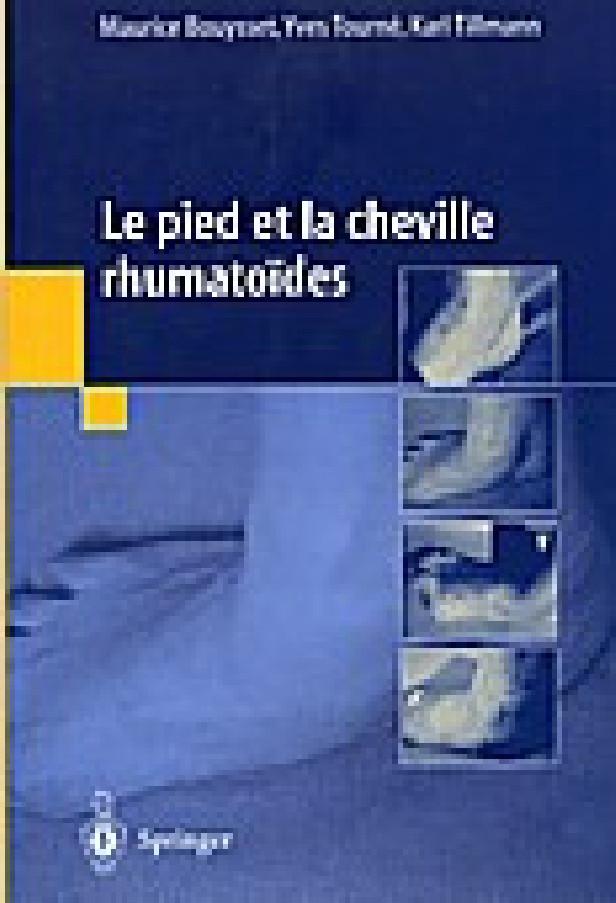 Le pied et la cheville rhumatoides