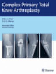 COMPLEX PRIMARY TOTAL KNEE...