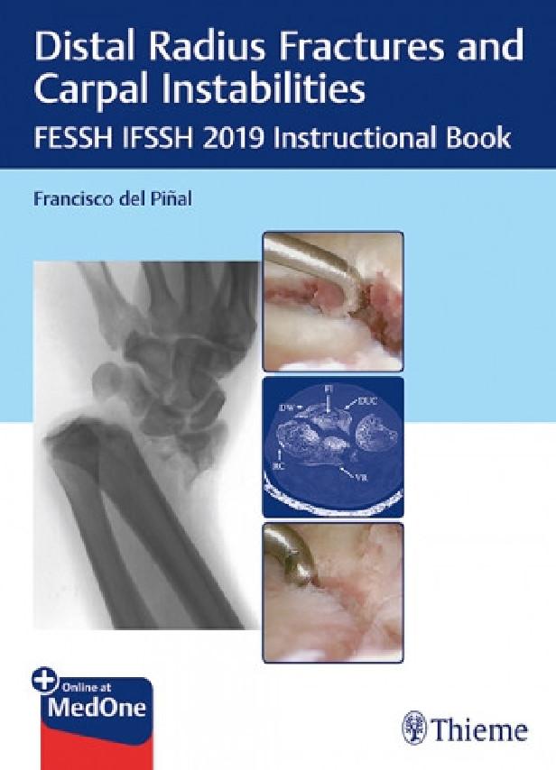 DISTAL RADIUS FRACTURES AND CARPAL INSTABILITIES