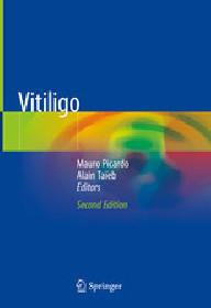 VITILIGO