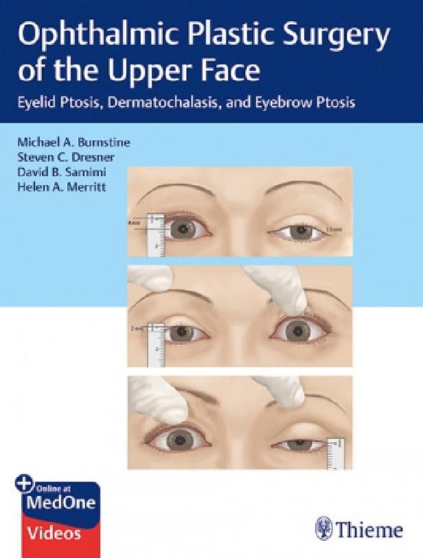 OPHTHALMIC PLASTIC SURGERY OF THE UPPER FACE