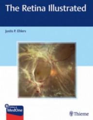 THE RETINA ILLUSTRATED